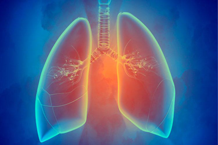 asma-750x500-c-default